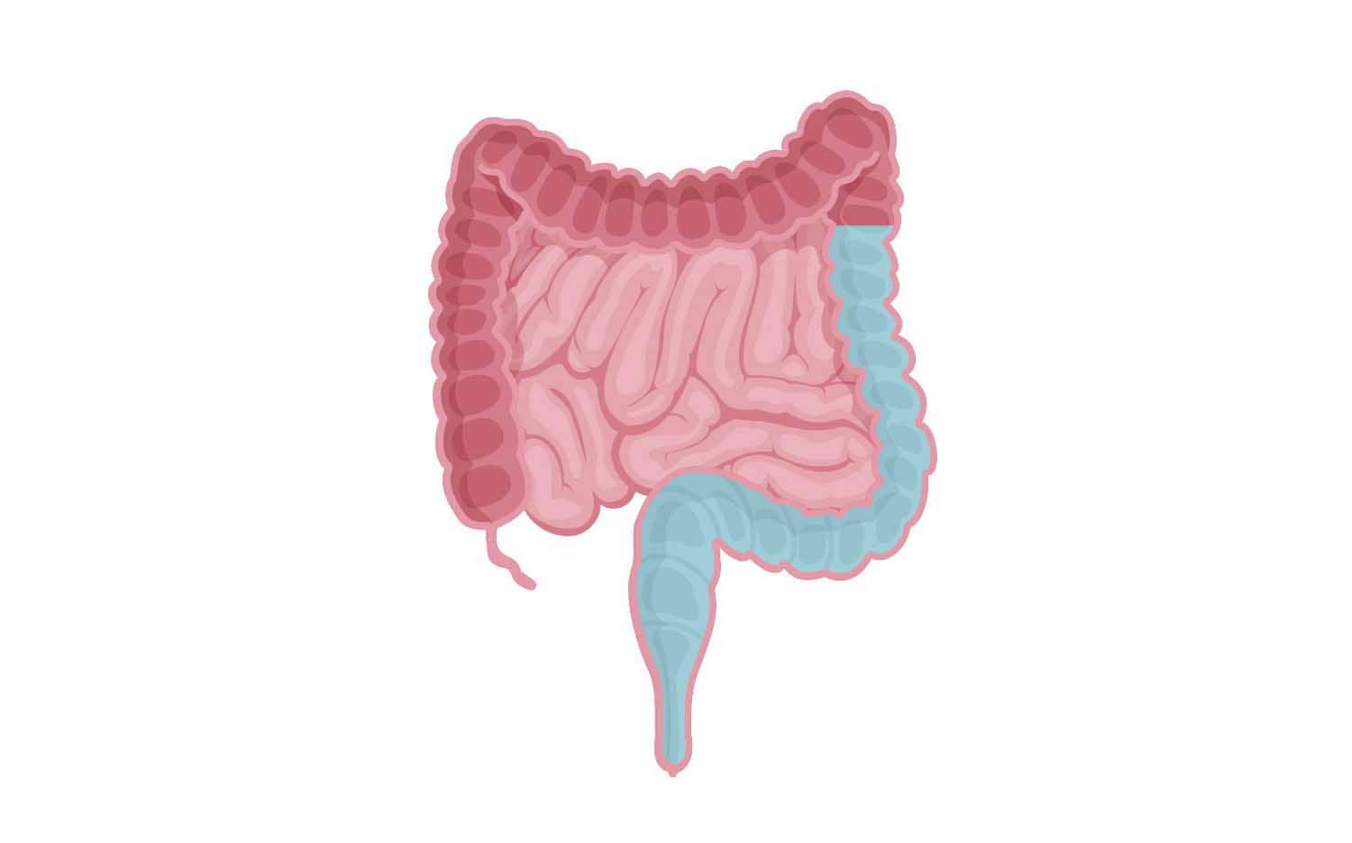 TAI mit hohem Volumen